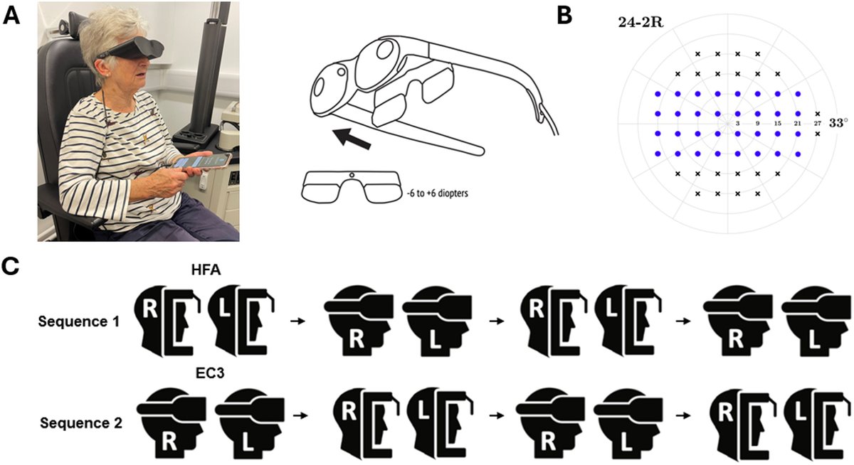 AAOjournal's tweet photo. On the feasibility of accelerating glaucoma clinical trials using portable perimetry
https://t.co/Rc0MAj12L7
#ophthalmology #glaucoma https://t.co/YijWmOKrti