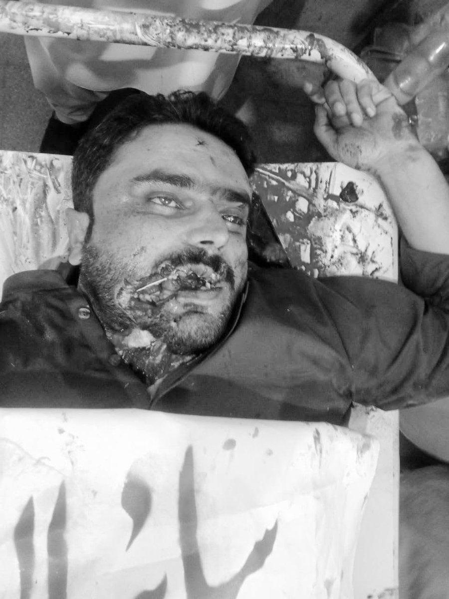 Deedagbaloch32's tweet photo. بلوچستان 🚨🚨 کے علاقے سبی جیل روڈ پرسلح افراد کی فائرنگ سے طارق ولد محمد خان قوم خجک اور سجاد ولد حاجی خان رئیسانی ہلاک ، جبکہ تین شدید زخمی ۔ ہلاک اور زخمی ہونے والے افراد کا تعلق ریاستی ڈیتھ اسکواڈ فرید گروپ سے ۔ مزید معلومات جاری۔
#Balochistan https://t.co/x5KUKENfGT