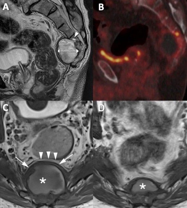 Journal of Neuroimaging tweet media