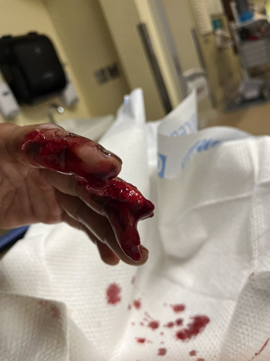 FameboyE's tweet photo. Crazy day at work today imma be straight tho 

#injury 
#hurt 
#sad
#care https://t.co/kIqa6XcrI4