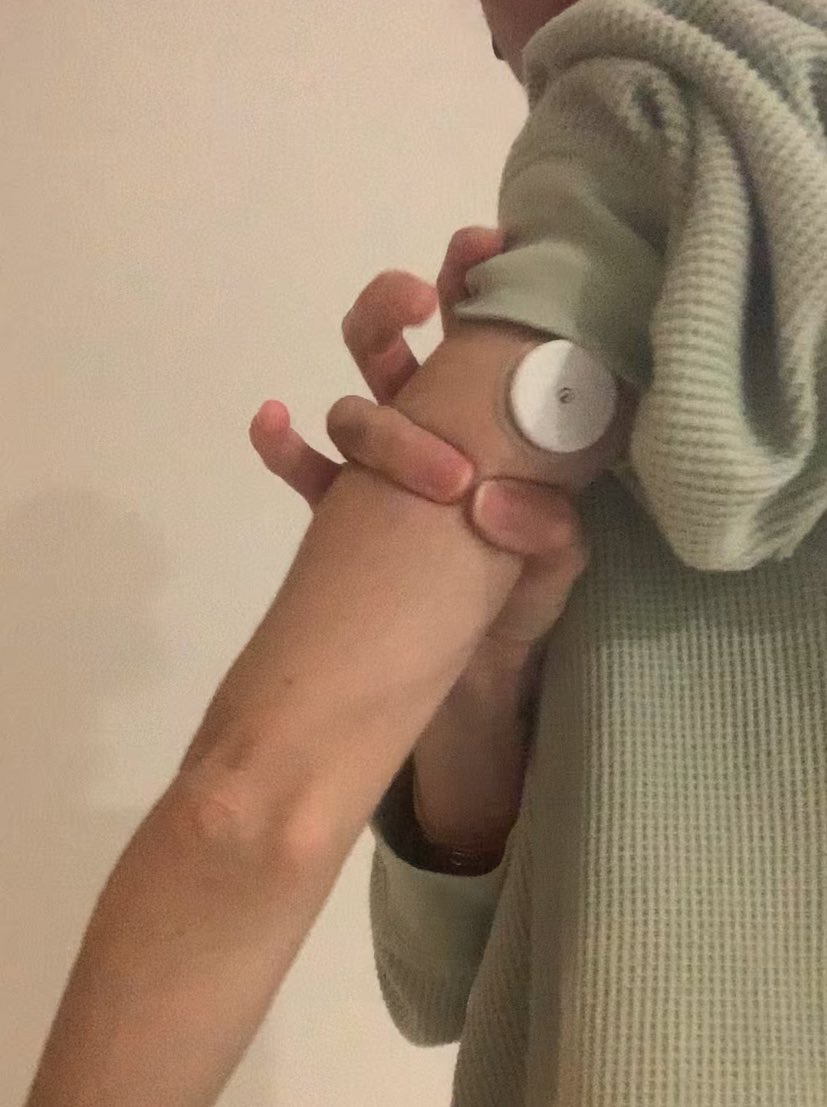 Arm still looks fat/ bulgey. 
But I haven’t been able to do this since I was at least 36kg. 
But am now 38.5 ish. Maybe higher. I am beyond confused.