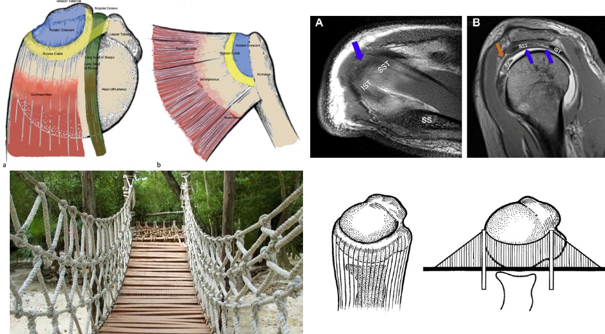 NickIlic_Physio's tweet photo. 🎯 New blog: Clinician’s Corner | The Importance of the Rotator Cuff Cable
🔗 https://t.co/XhSHmhyAzw
Why do some massive cuff tears do fine… while tiny ones collapse into pseudoparalysis?

👉 Subscribe: https://t.co/OgfxlIqgO4 https://t.co/12nWAXZ0E7