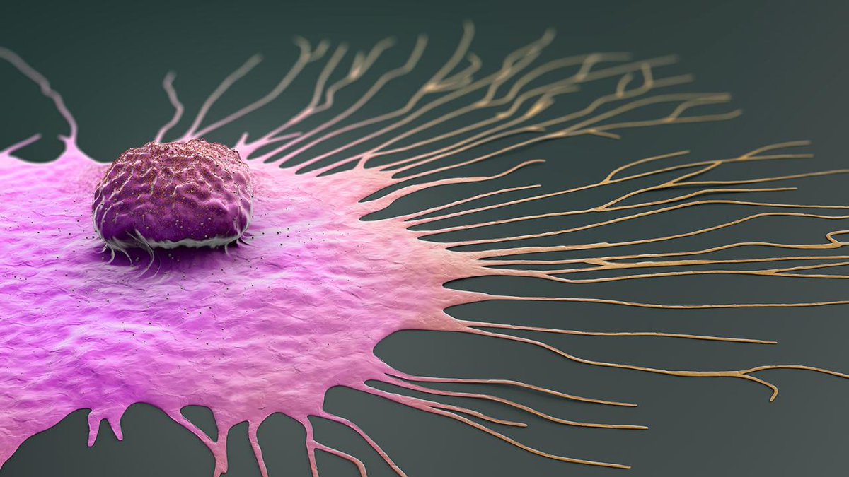 ColumbiaMSPH's tweet image. A Columbia Mailman study provides the first human evidence linking #BreastCancer to a chemical compound once used as an anticancer drug. The research also shows how metabolomics can uncover hidden environmental risks and improve prediction in high-risk women.…