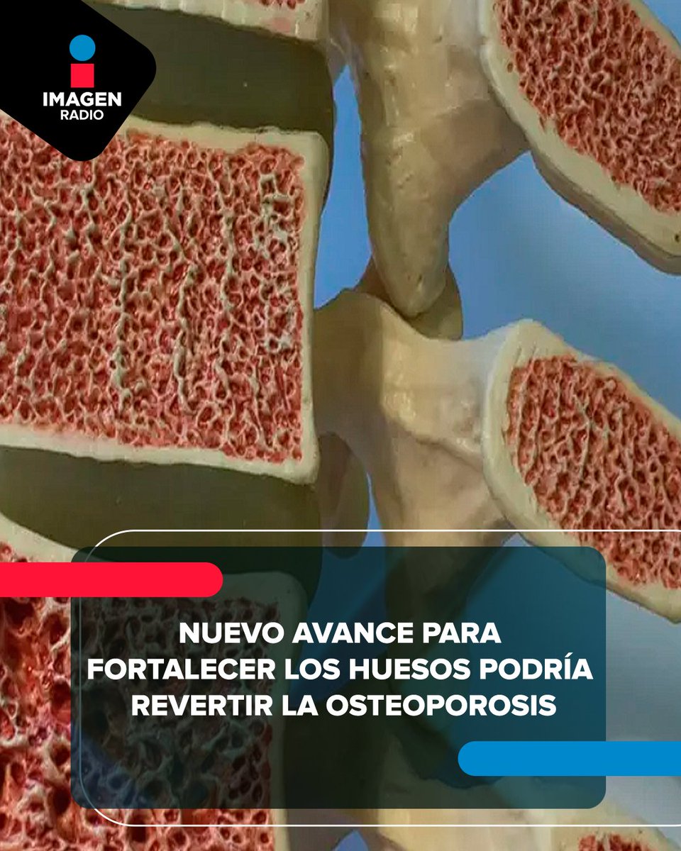 Imagen_Mx's tweet image. 🦴🩻⚕️ Un #avancecientífico promete fortalecer los huesos y revertir la #osteoporosis, ofreciendo nuevas esperanzas en el tratamiento de esta enfermedad.

La información a detalle: goo.su/J52kc