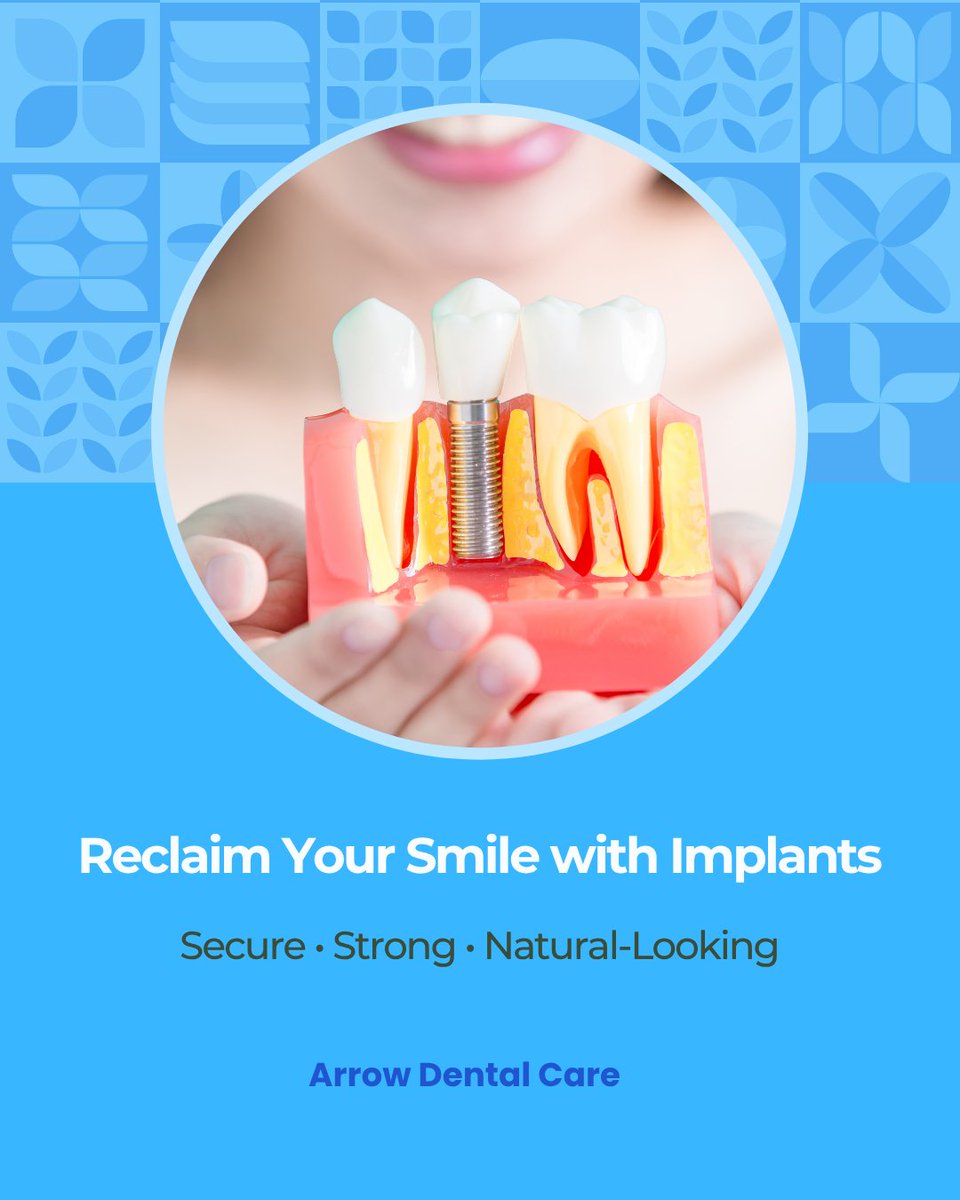 CareArrow's tweet photo. Unlike dentures or bridges, implants:
✅ Help prevent jawbone shrinkage
✅ Maintain your natural facial shape
✅ Don’t rely on neighboring teeth for support
✅ Can last decades with proper care

(636) 220-7770
https://t.co/L6UeLI3ptg https://t.co/vwUNhGrb9I