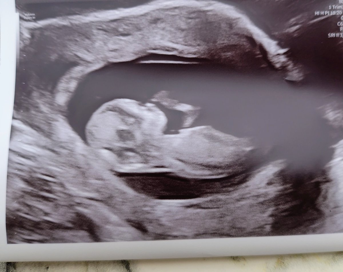 Things that make me feel sick right now:
Food
Music
Being awake
Literally any smell
Reading ☹️
Being hungry

The only things that don't make me feel sick right now:
Gilmore girls
Cheesy doritos

Baby number 2 arriving next year!