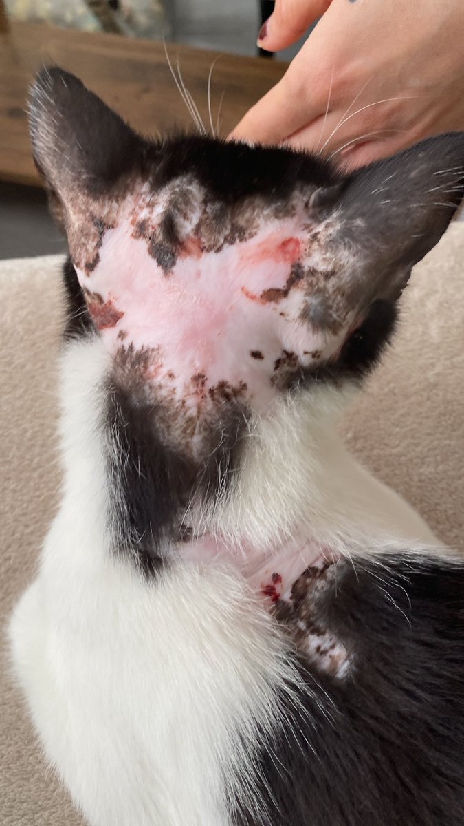 Kafası sürekli yırtılıyor, acıyor, sürekli bağışıklığı düşüyor. Hala da borcunu ödeyemiyorum. Hastalandığında gittiğimiz bir kapımız vardı ondan da olduk. ben bulmadım, ben görmedim, evimi açtım yine de. Tedavisini üstlendim. Geçici annesi oldum. 90 kişi 300 eksik kaldı. paylaşır