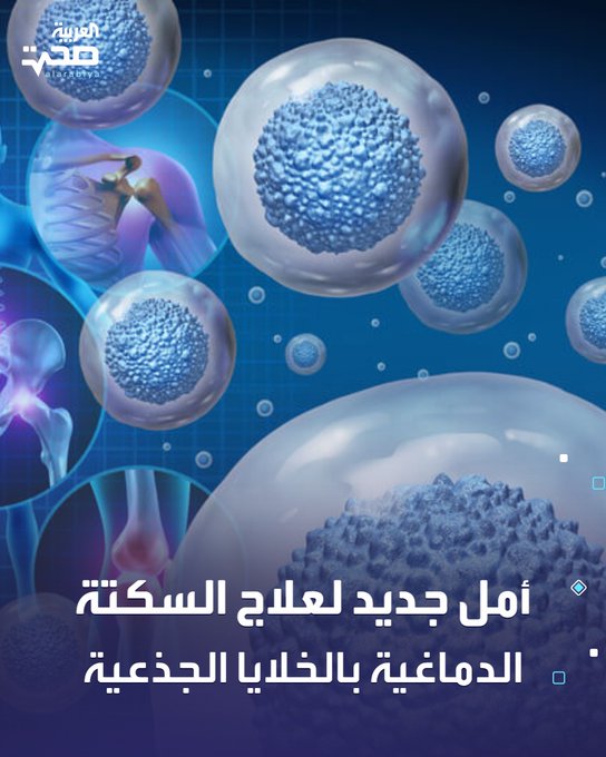 أظهرت دراسة جديدة من جامعتي زيورخ وجنوب كاليفورنيا أن حقن الخلايا الجذعية قد يساعد في علاج تلف الدماغ الناتج عن السكتة الدماغية.. إذ طوّرت الخلايا الجذعية البشرية، المحقونة في أدمغة فئران مصابة، خلايا عصبية غير ناضجة تحوّلت لاحقًا إلى خلايا عاملة تواصلت مع الخلايا المحيطة، ما يفتح أملًا لاستعادة الوظائف المفقودة لدى المرضى، وفقًا ل Science Alert. صحة _صحة 
