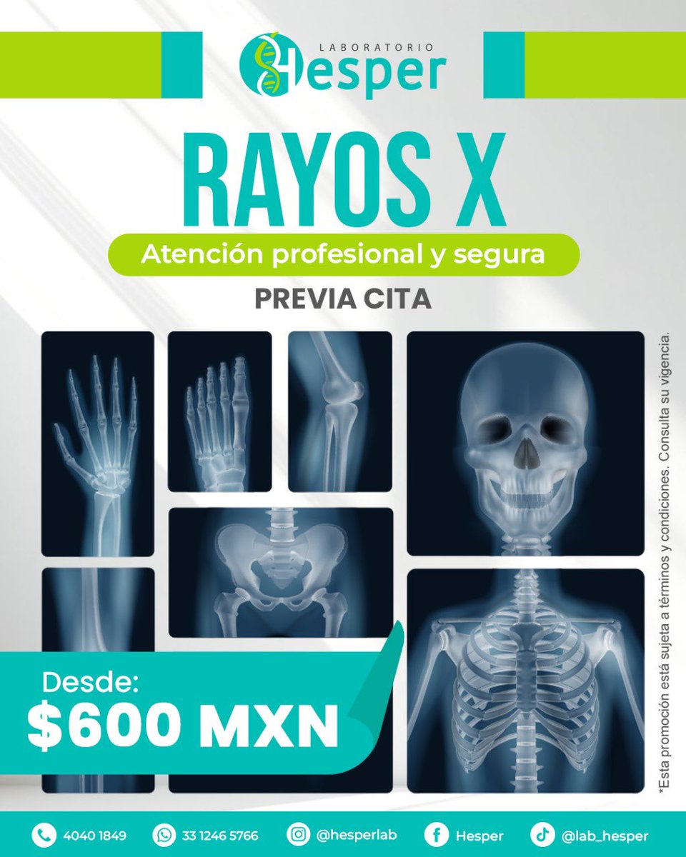 Hesperlab's tweet image. En 𝗟𝗮𝗯𝗼𝗿𝗮𝘁𝗼𝗿𝗶𝗼 𝗛𝗲𝘀𝗽𝗲𝗿, tu salud es nuestra prioridad 🔬✨  

Contamos con tecnología avanzada en 𝗥𝗮𝘆𝗼𝘀 𝗫 para brindarte diagnósticos precisos, rápidos y confiables. 
¡Tu bienestar está en buenas manos! ✅🧪🧫

📞 4040 1849
📱 𝐖𝐡𝐚𝐭𝐬𝐀𝐩𝐩: 33 1246 5766