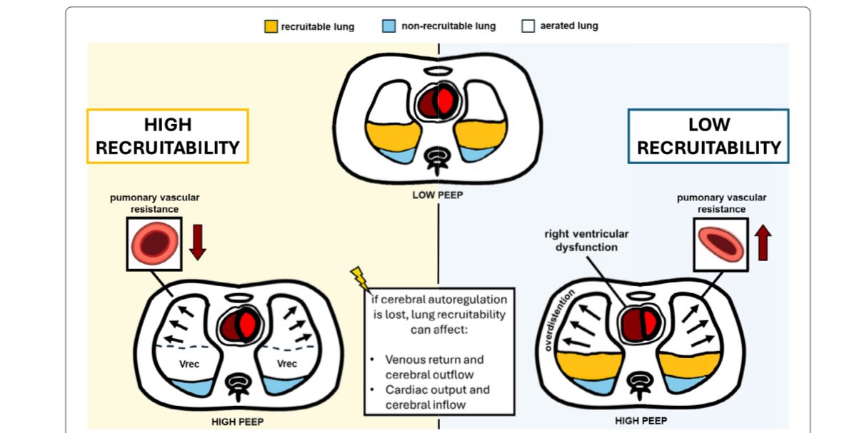 chiara_robba's tweet image. Peep in acute brain injured patients 
ICM2025