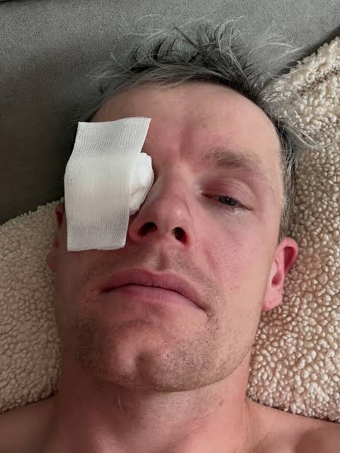 versepers's tweet photo. Enzo Knol (32) had deze week een pechweek: gebroken voet tijdens Creators FC, ziekenhuisbezoek en mogelijk operatie, plus een ongeluk met zijn 3D-printer waardoor hij 24 uur met oogkap liep. Toch blijft hij positief en gaat vrolijk door met vloggen. https://t.co/dpGiIesTEI