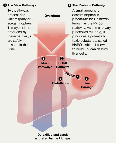 When Tylenol (acetaminophen) is not properly metabolized, it creates a  toxic biproduct. The process to metabolize acetaminophen is called  glucuronidation. This process is underdeveloped in young babies.