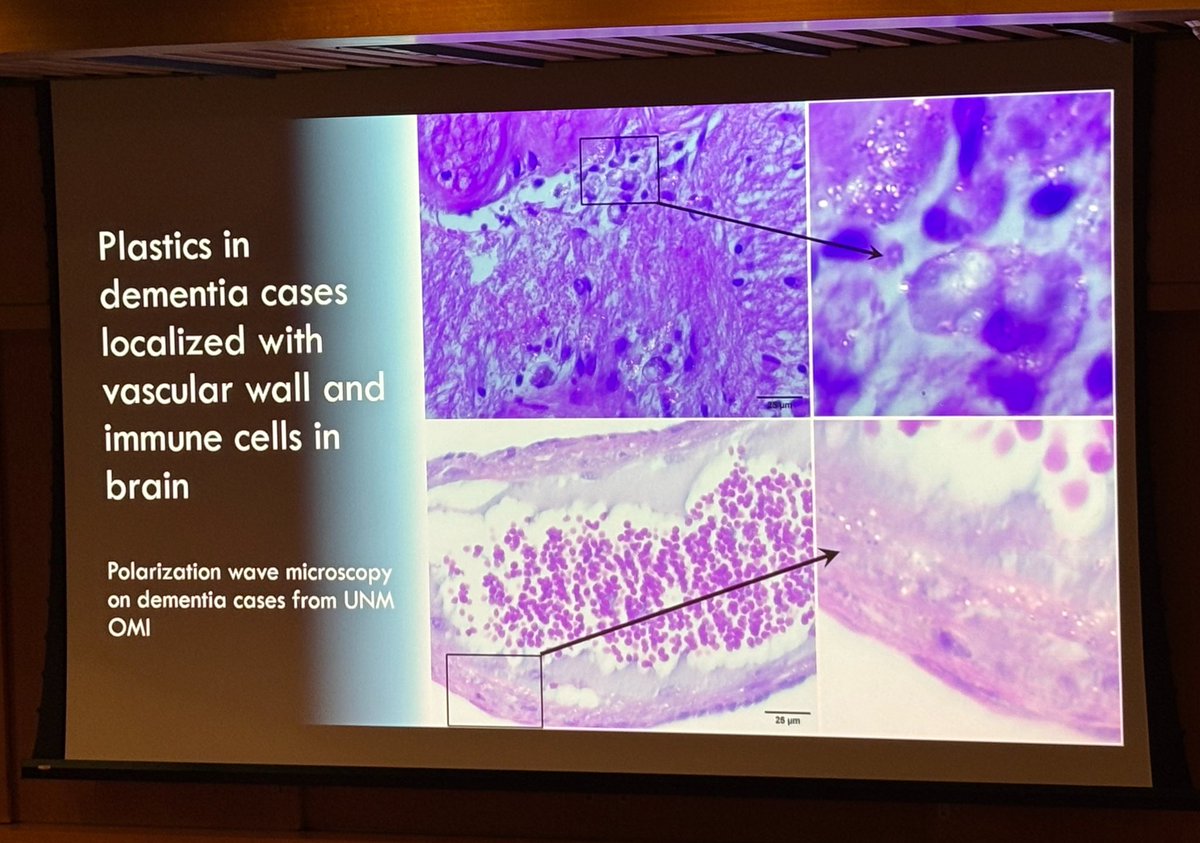 A very thought provoking symposium on Plastics and Human Health organized by <a href="/leotrasande/">Leo Trasande, MD, MPP</a> <a href="/NYULHCIEH/">NYU Langone Health | CIEH</a> at <a href="/nyulangone/">NYU Langone Health</a> today. The impact of micro and nanoplastics (&amp; their associated chemicals) on disease pathology is real. We need to carefully think of avenues for mitigation.