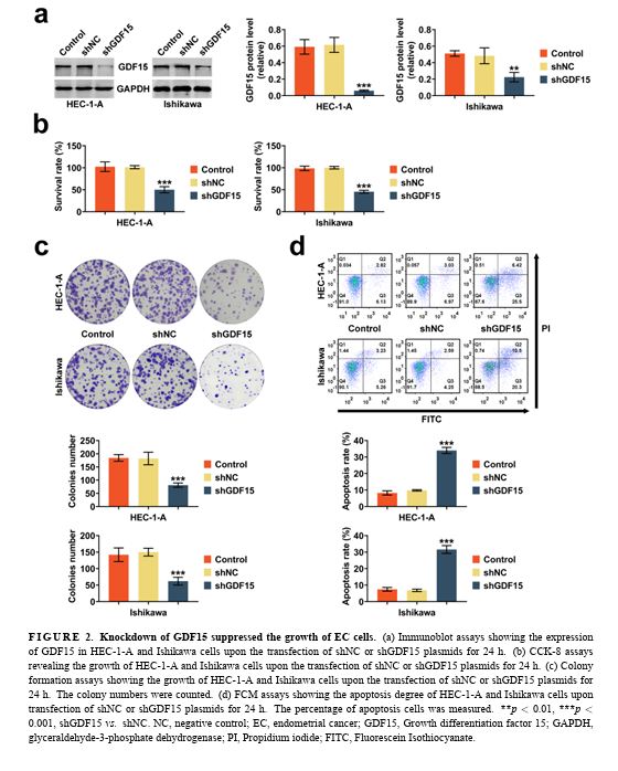 🩺Study: GDF15 drives endometrial cancer growth via TGF-β/Smad2/Smad3. Knocking it down shows promise!
📚Read more:ejgo.net/articles/10.22…
#EndometrialCancer #Oncology #Research