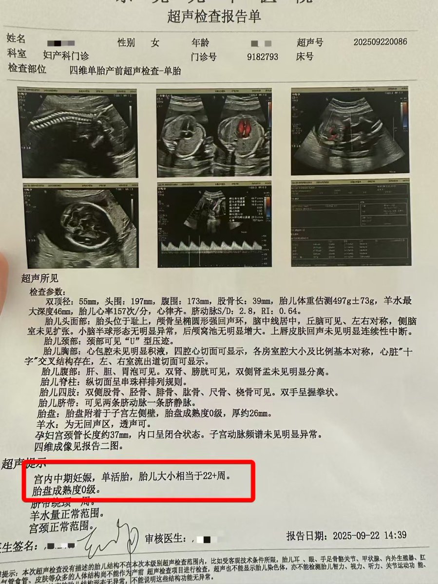 🌈#单胎 时光🌈▫️22周记▫️
🔍四维彩超🔍✅一切正常✅

专业试管代孕咨询微信：a18025307951
#HIV生子 #三代代孕 #失独代孕 #二代代孕 #包成功代孕 #洗精代孕 #三代包成功 #选性别代孕 #女性代孕 #男性代孕 #夫妻代孕 
#试管婴儿 #试管助孕 #代孕 #广州代孕