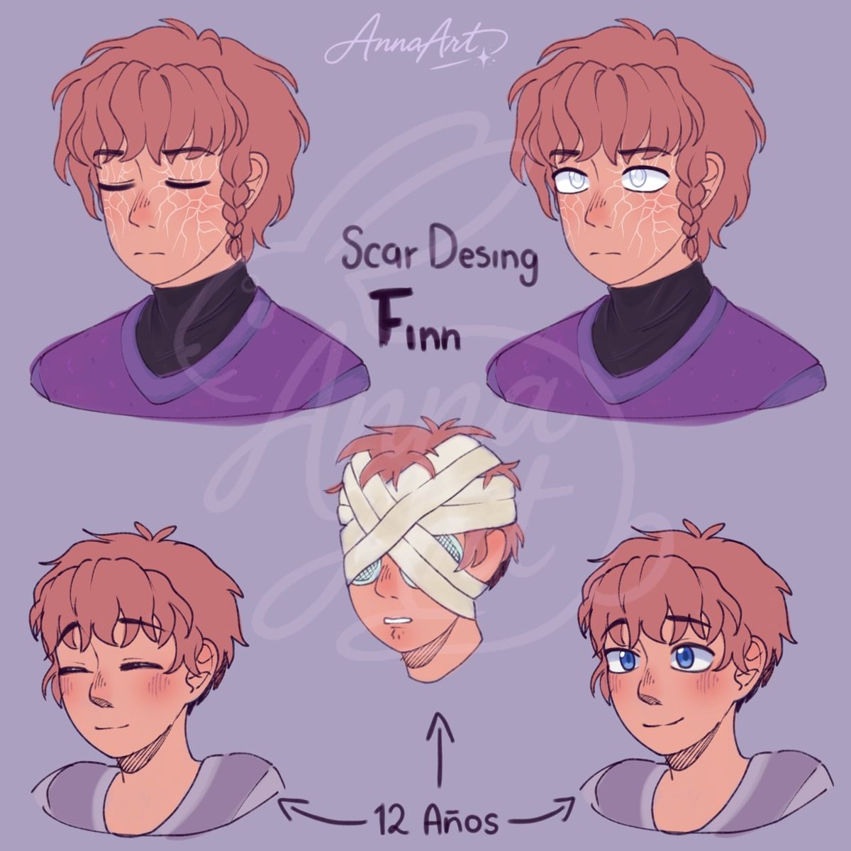Anna_art20's tweet photo. Nuevo dato curioso de Finn, cuando el recibió el impacto del GB de Fredd le quedaron sicatrices internas que afectaron su vista, pero con el tiempo le fueron creciendo cicatrices blancas en la cara, que cuando activa su poderes brillan junto a sus ojos ✨ https://t.co/JxeJMVwxJn