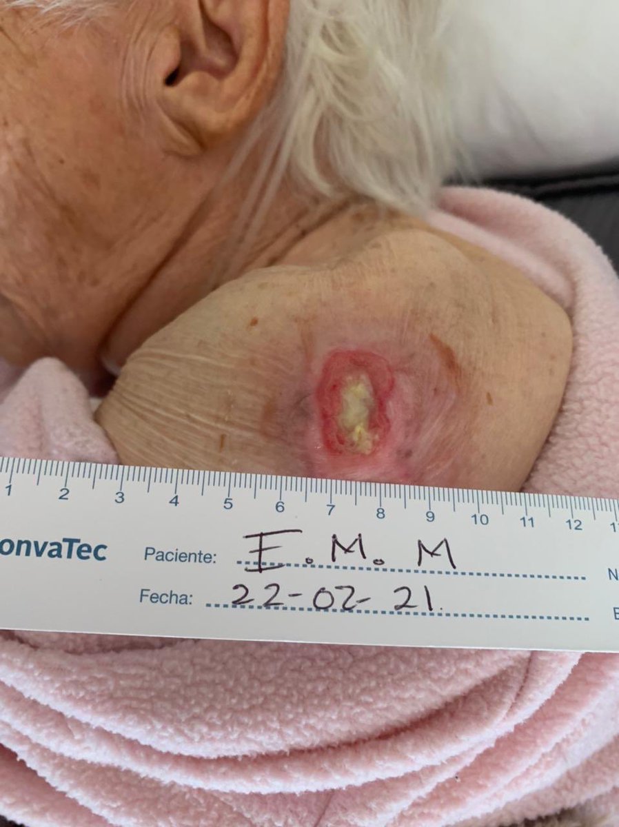 LAURAZAPATAM's tweet image. Jessica de Jesús Martínez, la enfermera asesina, dice que yo “solo le daba 1 pañal al día y 1 en la noche”.

📸 Aquí está mi abuela con una paleta y atrás el clóset lleno de pañales.
Su mentira se derrumba.

Y pregunto:
¿Las heridas del hombro y del pie también fueron por falta…