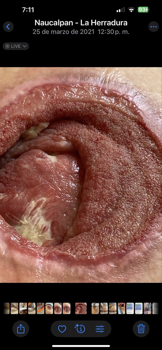 LAURAZAPATAM's tweet image. Jessica de Jesús Martínez, la enfermera asesina, dice que yo “solo le daba 1 pañal al día y 1 en la noche”.

📸 Aquí está mi abuela con una paleta y atrás el clóset lleno de pañales.
Su mentira se derrumba.

Y pregunto:
¿Las heridas del hombro y del pie también fueron por falta…