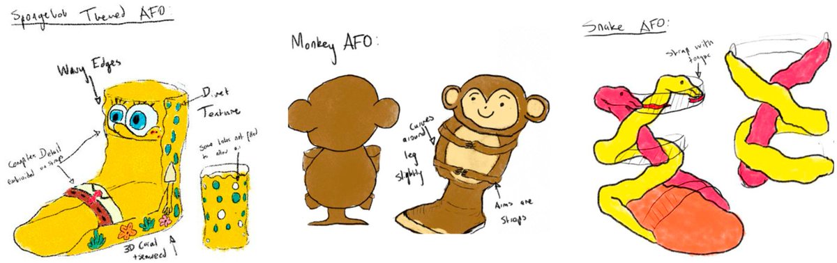 Prosthesis_MDPI's tweet image. User-centered framework for personalized AFOs—boosts compliance via kid aesthetics, 3D printing &amp;amp; FEA! 🦶✨ Solves low pediatric rehab adherence, blending comfort/function/style. 🧑⚕️👶 

doi.org/10.3390/prosth… 

#PediatricOrthotics #UserCenteredDesign #3DPrintedMedicalDevices