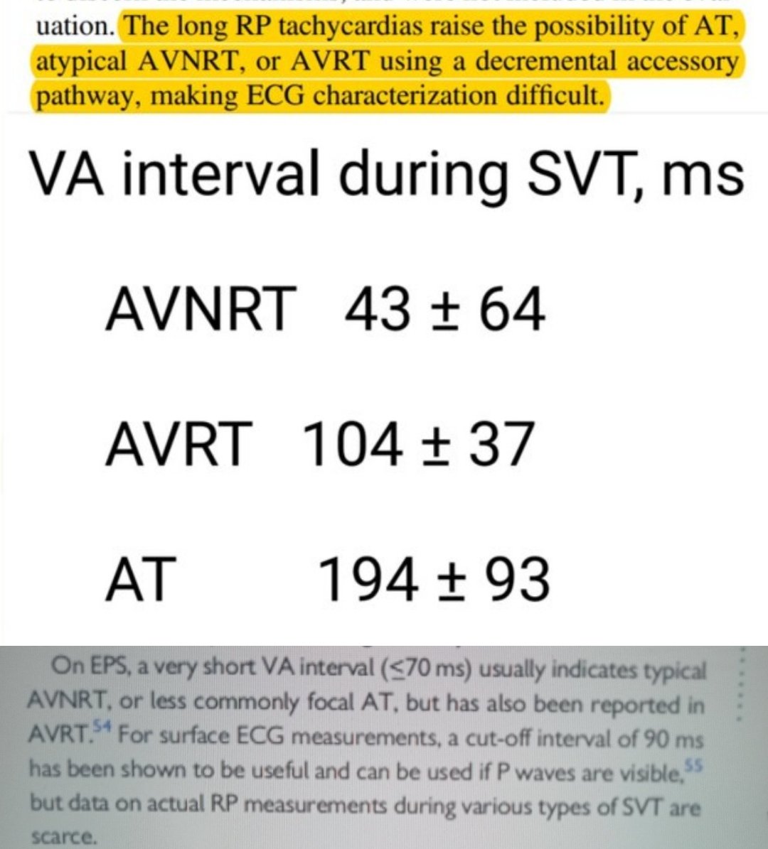 VA intervals reflect the anatomy of reentry circuits.
🟢 43 msec - AVNRT the reason P is often burried in QRS.
🟡 104 msec - AVRT the reason the impulse gets to AP after the QRS is activated.
🔴 194 msec - AT no reentry; more A to V patterns of conduction.
x.com/KostekMilan/st…