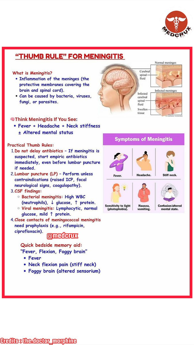 👨‍⚕️ Thumb rule for meningitis  🧠