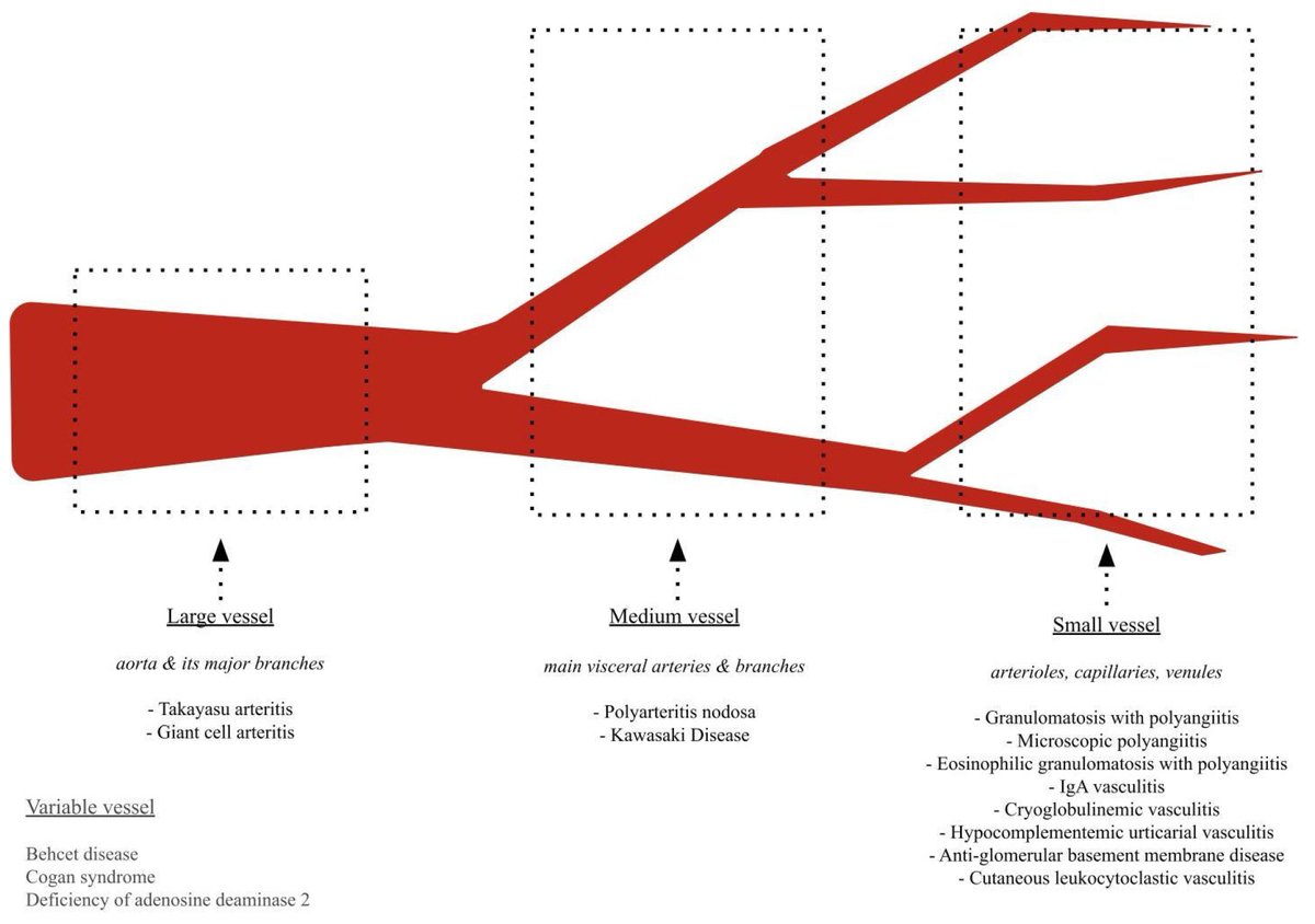 🔔#Allergies_MDPI Welcomes you to read our publication "Biologic Therapies and Janus Kinase Inhibitors for Medium and Variable Vessel Vasculitides: A Review of Clinical and Preclinical Evidence" by Ms. Allison Bai et al.

✅Link: brnw.ch/21wW0Zs

#Vasculitis #MDPI