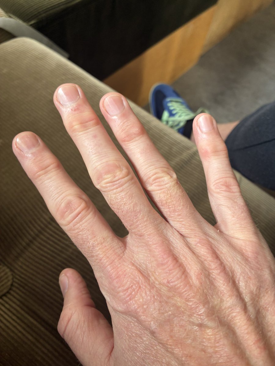 I think my hand modelling days are over #jits