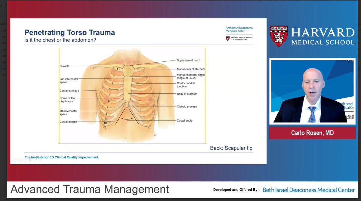 Emerg_Quality's tweet photo. Thanks to our 80 participants (from 21 countries) for a FANTASTIC discussion yesterday on important trauma topics - trauma in pregnant, elderly and hypotensive pts, torso trauma, MTP, anticoag reversal, pediatric trauma @BIDMCEM @HMFPBoston https://t.co/vGwABx21eM