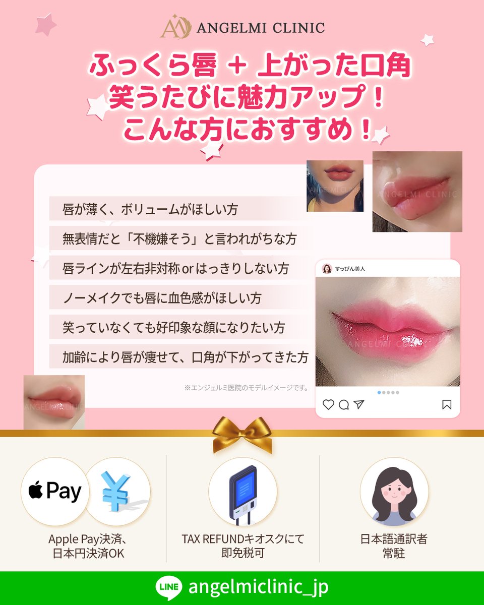 angelmiclinic's tweet image. 印象はやわらかく、
唇はくっきり！💋

♥️ 唇フィラー × 口角ボトックス ♥️
➡️ 108,900ウォン（税込）

エンジェルミ医院で
ふっくらとした唇ラインと、
いきいきとした表情を一度に！ 🥰
#ふっくら唇 
#ボリュームリップ 
#口角アップ

ブログで詳しくご紹介中です。ぜひご覧ください😊…