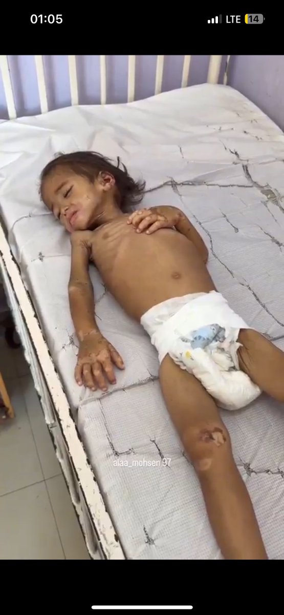 Bugün Gazze’de 3 çocuk daha açlıktan hayatını kaybetti. Hem de İsrail’in “güvenli bölge” olduğunu iddia ettiği güneyde.

İsrail’in öldürücü ablukası sebebiyle açlıktan hayatını kaybedenlerin sayısı 500’e yaklaştı.

#GazaStarving