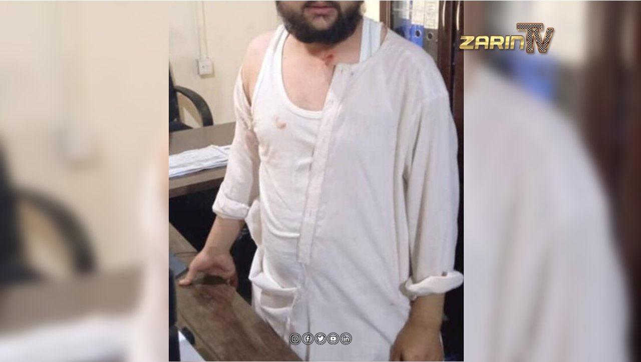 طالب یک کارمند شفاخانه را در تخار لت و کوب کرد