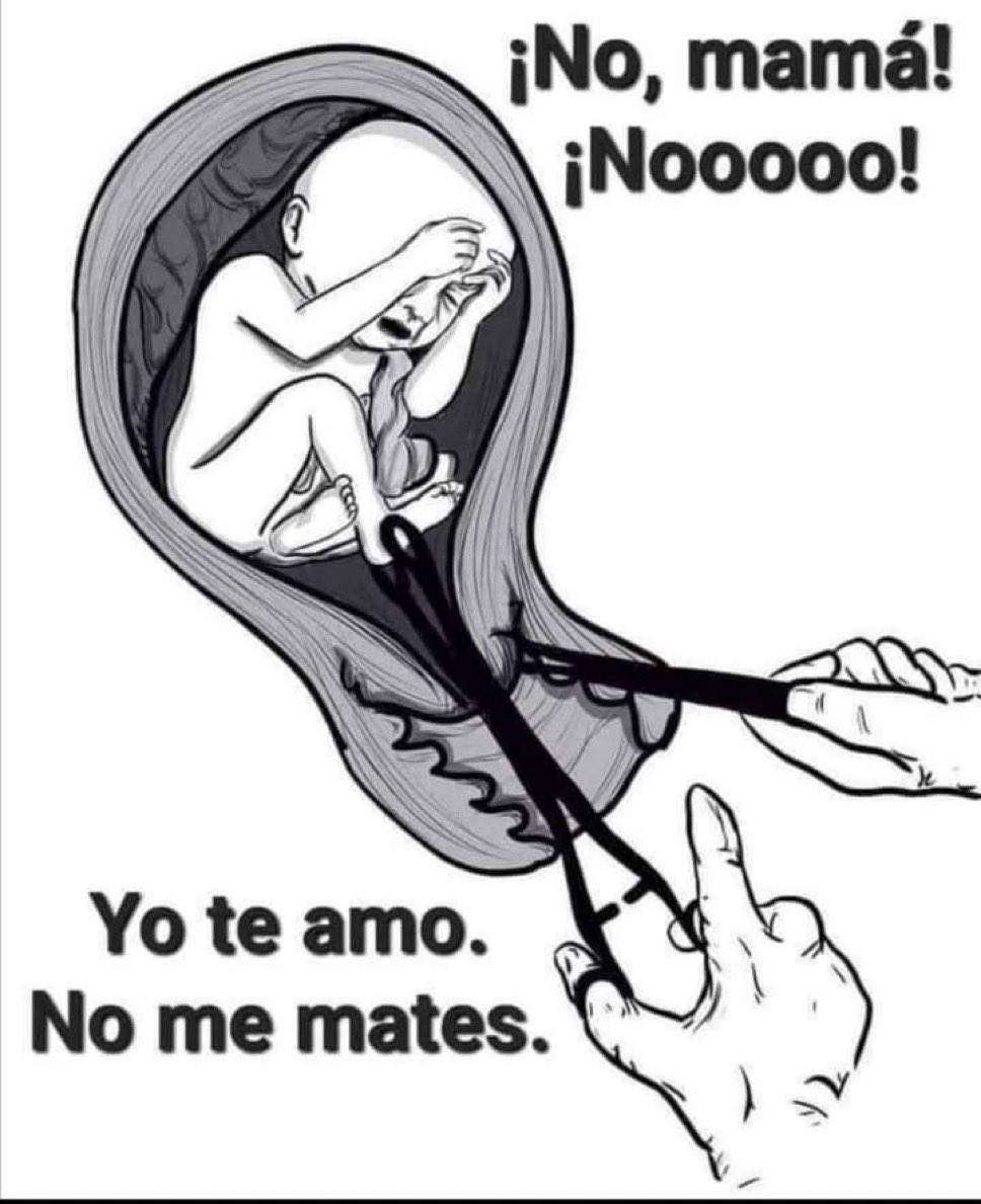 porlavida2014's tweet image. La inhumana y cruel realidad del #aborto...
#SiaLaVida
