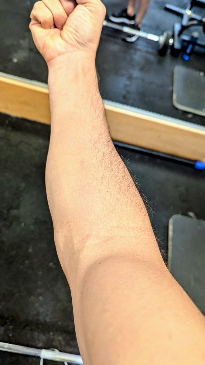 מסתבר שיש לי דלקת בשריר הבייספ אז אימון ידיים היום זה forearms בלבד ולראשונה