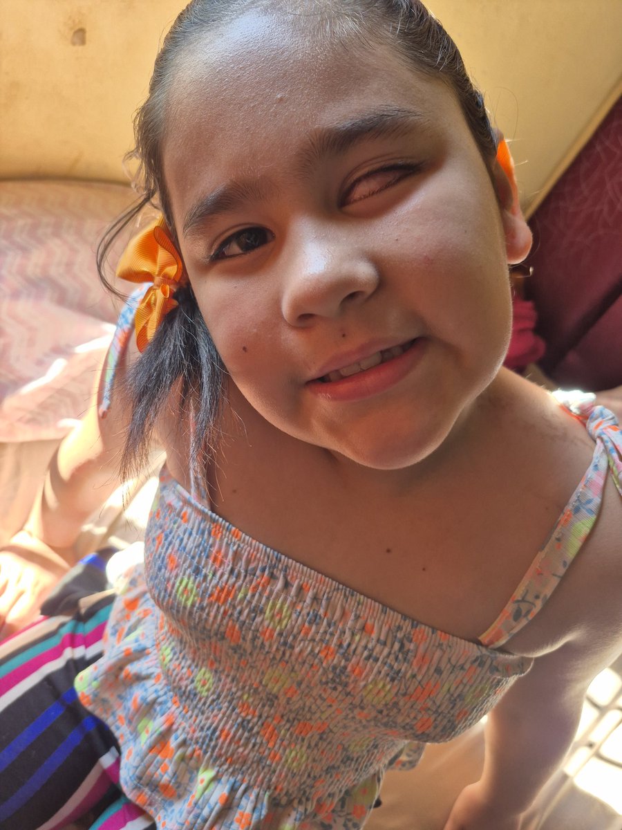 En el único ojito de thais el tumor esta siendo agresivo Vuelve a frotar nuevs tumores al rededor de cual se trato muchos años por favor ayúdenme poder lograr juntar lo que necesito para poder irnos siempre a fecha para que le resulte la quimiointravitrea a thais y salve su ojito