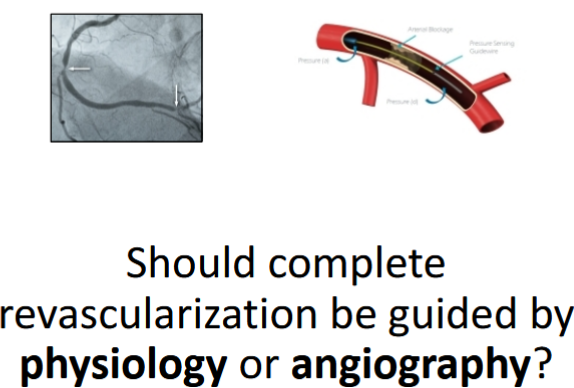 Treatment dilemmas in STEMI patients with multivessel disease

🔗pcronline.com/Cases-resource…
(access via your free My PCR account)

View the replay 📺 of this session focused on imaging and physiology-guided  revascularisation strategies. Learn optimal approaches for cases with  CABG