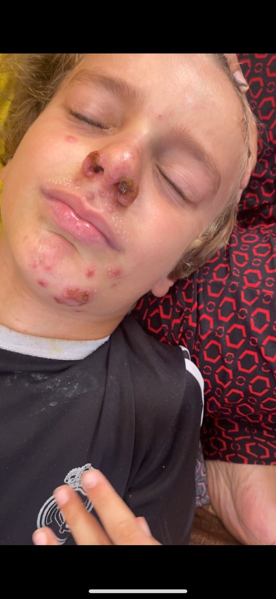 yousef_hosam7's tweet image. 🛑Donation link in bio ☝️🙏, please don&apos;t skip, for my little brother we need the remaining amount to get the medicine $180 he cries from pain all the time, share and repost please😔💔