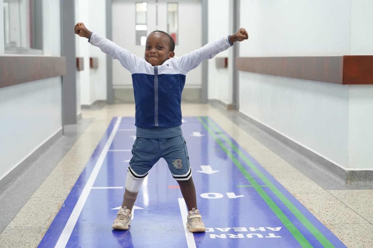 From sitting on the sidelines to running with friends!
With a 3D-printed below-knee socket, this little one can walk, play, and dream big. Your steps in the #CoRSUWalk2025 will help more children experience the same joy. 

#WalkForChange