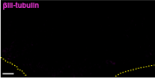 Cancer Immunology Research tweet media