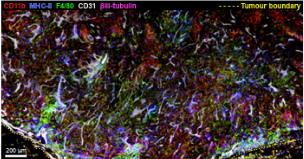 Cancer Immunology Research tweet media