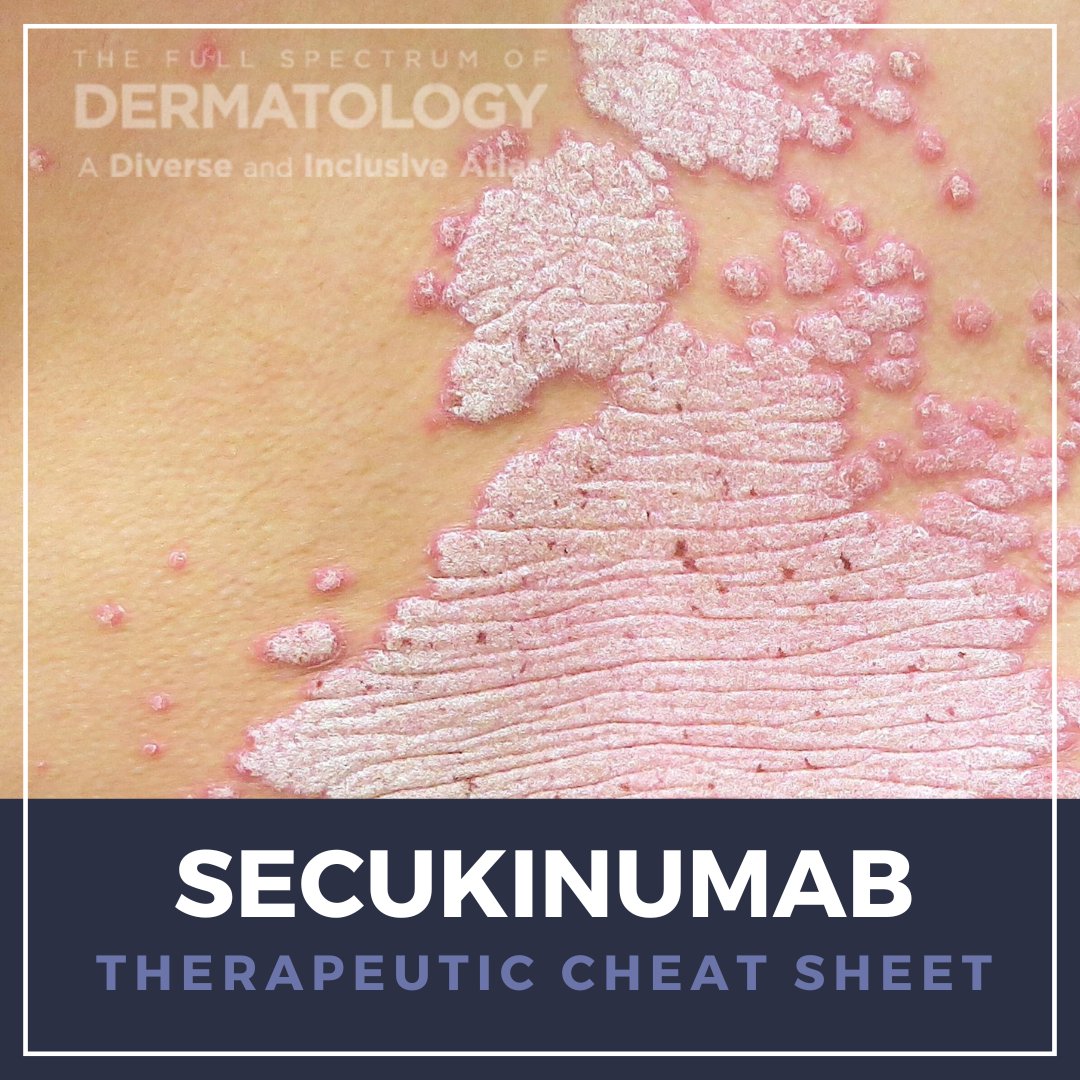 Our partner <a href="/nextsteps_derm/">Next Steps in Derm</a> shares this new cheat sheet for prescribing and managing patients on secukinumab: ow.ly/B3Gb50X0lt1

Learn the MOA and dermatologic uses, as well as side effects, and warnings and precautions. 

#Secukinumab #DermatologyEducation #PsoriasisCare