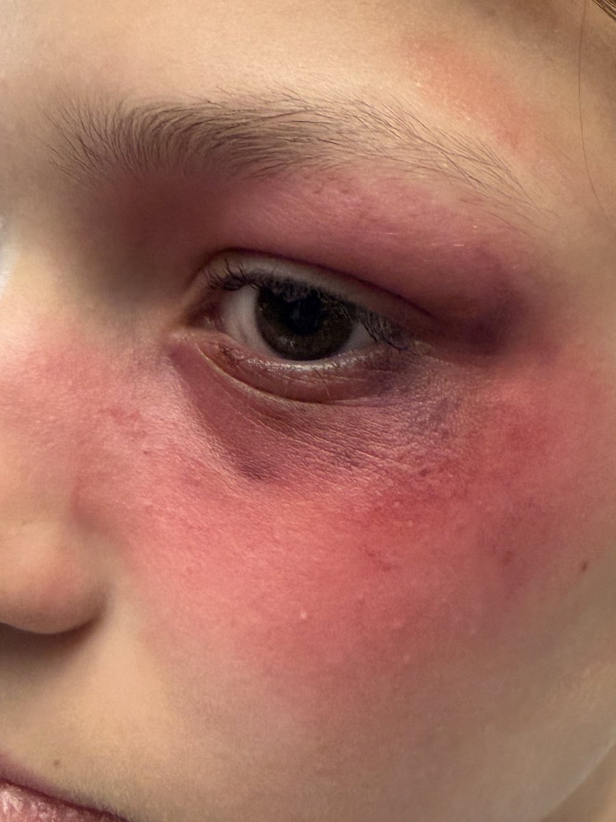 S2 Personalisation and Choice Drama class smashing stage makeup this quadrant!  This week they were learning about bruise application with a bruise wheel!