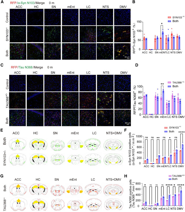 NeuroCellPress's tweet photo. Online now:  Gut-induced alpha-Synuclein and Tau propagation initiate Parkinson’s and Alzheimer’s disease co-pathology and behavior impairments https://t.co/HBx5cZcK47 https://t.co/GogBZuwo2n