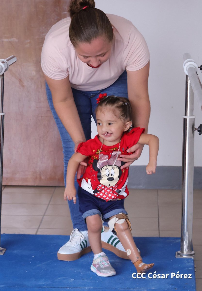 Nació sin su pierna izquierda y hoy ya tiene su prótesis. gracias al hermanamiento entre Nicaragua e India. Nos referimos a la menor Neylan Pérez de un año de edad.
La niña vive con su familia en el barrio Omar Torrijos en Managua, ahora podrá caminar y correr por toda la casa.