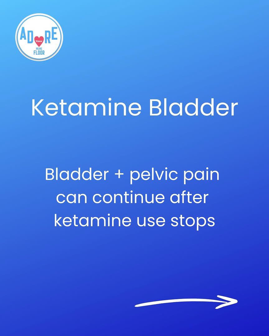 👀FREE RESOURCE👀  *COMING SOON*
Bladder + pelvic pain can persist after ketamine use stops

Currently meds and surgical procedures are implemented as the first line of approach

We have put together a  project with focus to conservative treatment👍

<a href="/pelvicroar/">pelvicroar</a> <a href="/BladderHealthUK/">Bladder Health UK</a>
