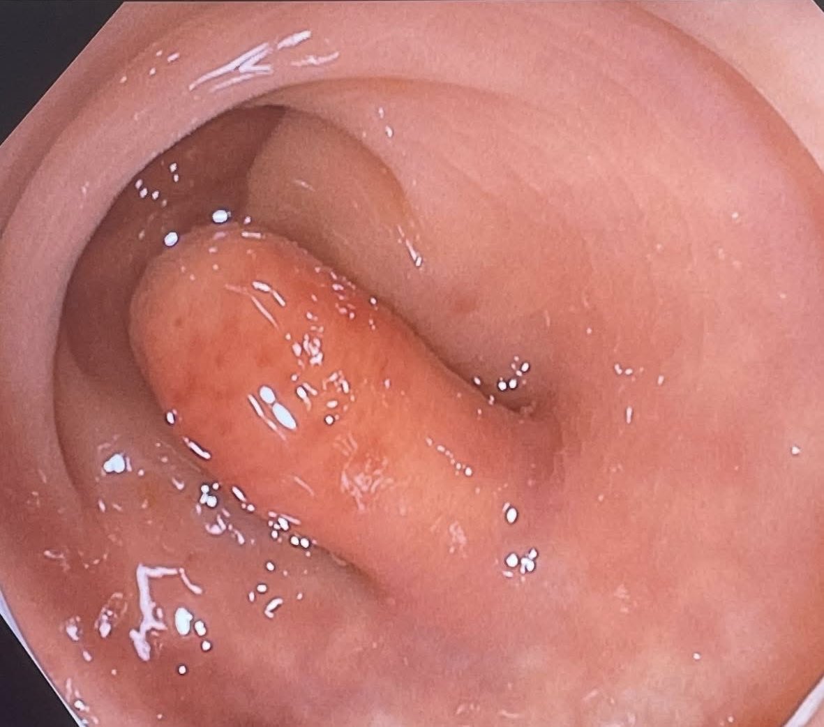 Would you take off this polyp?

📸: Ahmed Shadi