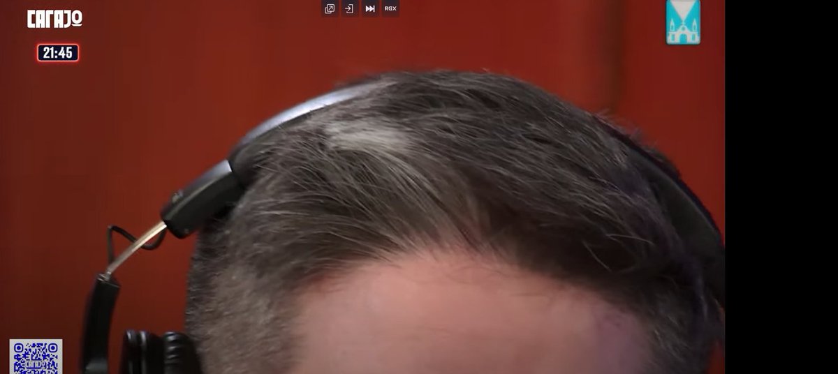 Ves esto y estas a punto de escuchar la opinion mas basada de todas