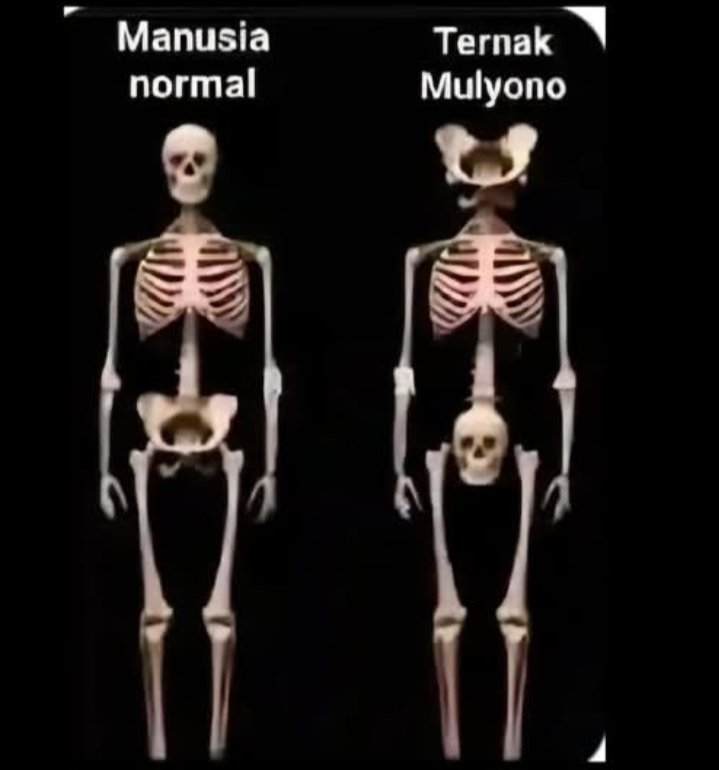 Perbedaan Struktur anatomi manusia biasa dan ternak Mulyono setelah ditemukan oleh kedokteran Indonesia sangat mencengangkan dunia kedokteran di Indonesia