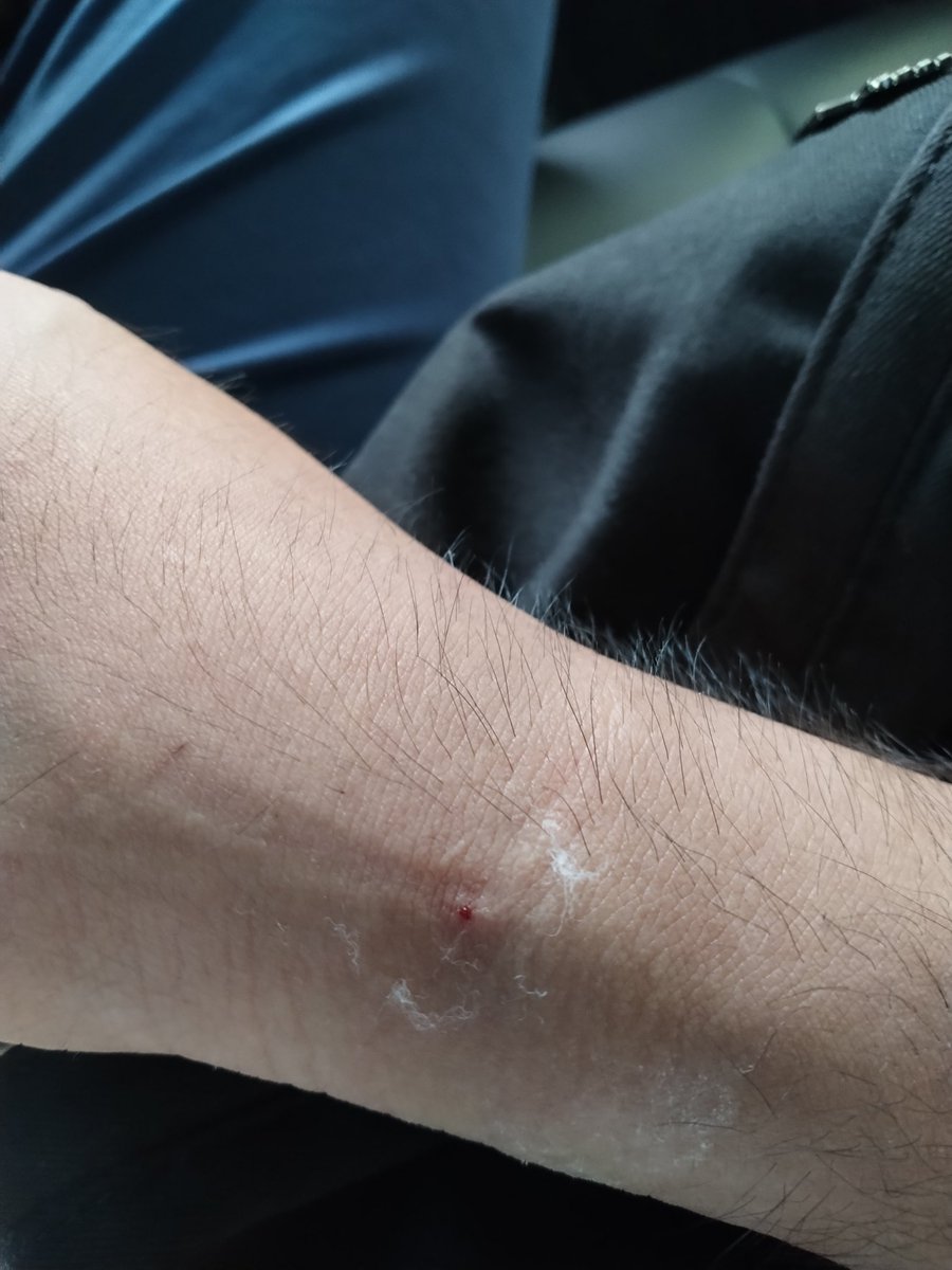 本来还想说今天周三放台风假更新一下的，但是我周一研学的时候因为在蔬菜大棚里太热然后晕倒了，这几天不舒服qwq