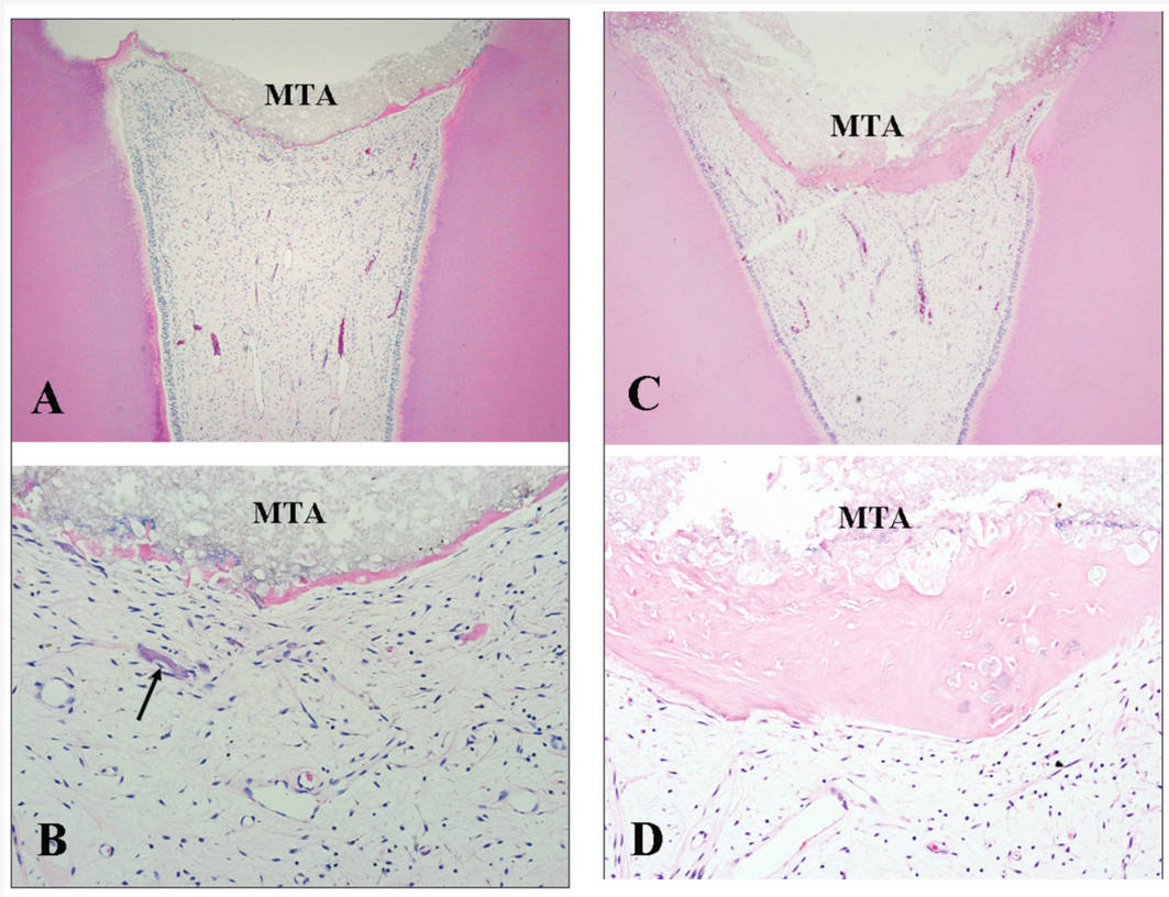 📢 Feel free to read our "Highly Cited Paper"

📚  Title: Diagnostic and Prognostic Predictors for the Success of  Pulpotomy in Permanent Mature Posterior Teeth with Moderate to Severe  Pulpitis: A Scoping Review
🔗 mdpi.com/2673-6373/3/4/…
👨‍🔬 by Helen McHugh,  Ove Peters et al.