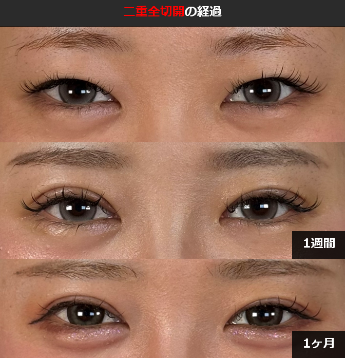 くりりんさま確認ページ♡ 居候